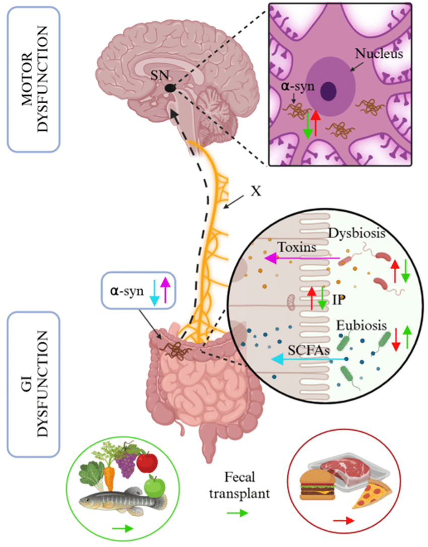 Per què cada vegada hi ha més problemes digestius? Per què cada vegada hi ha més problemes digestius?